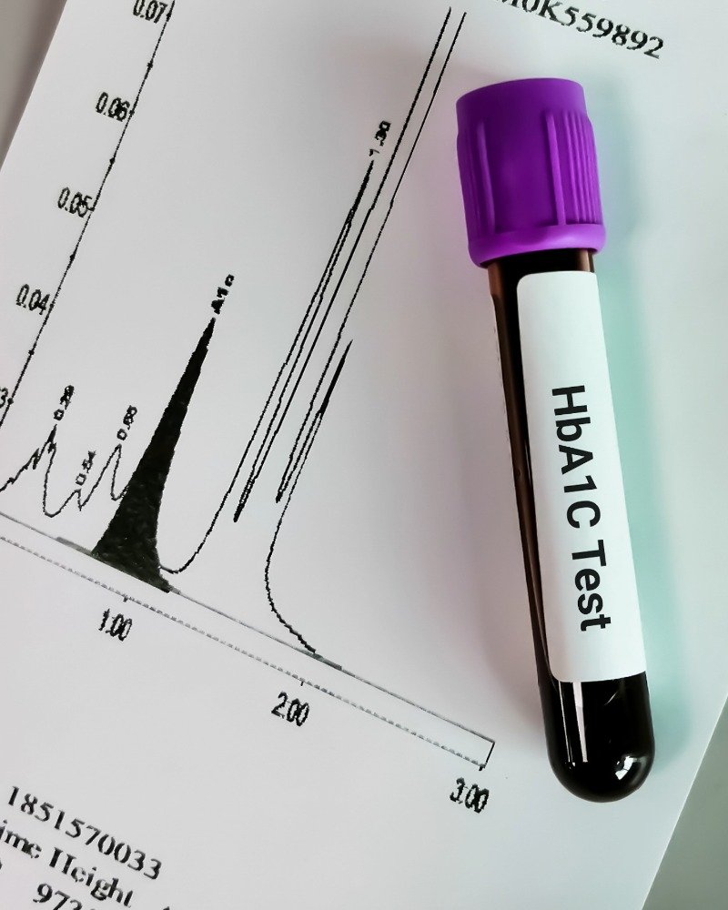 HbA1c लक्ष्य और डायबिटीज नियंत्रण