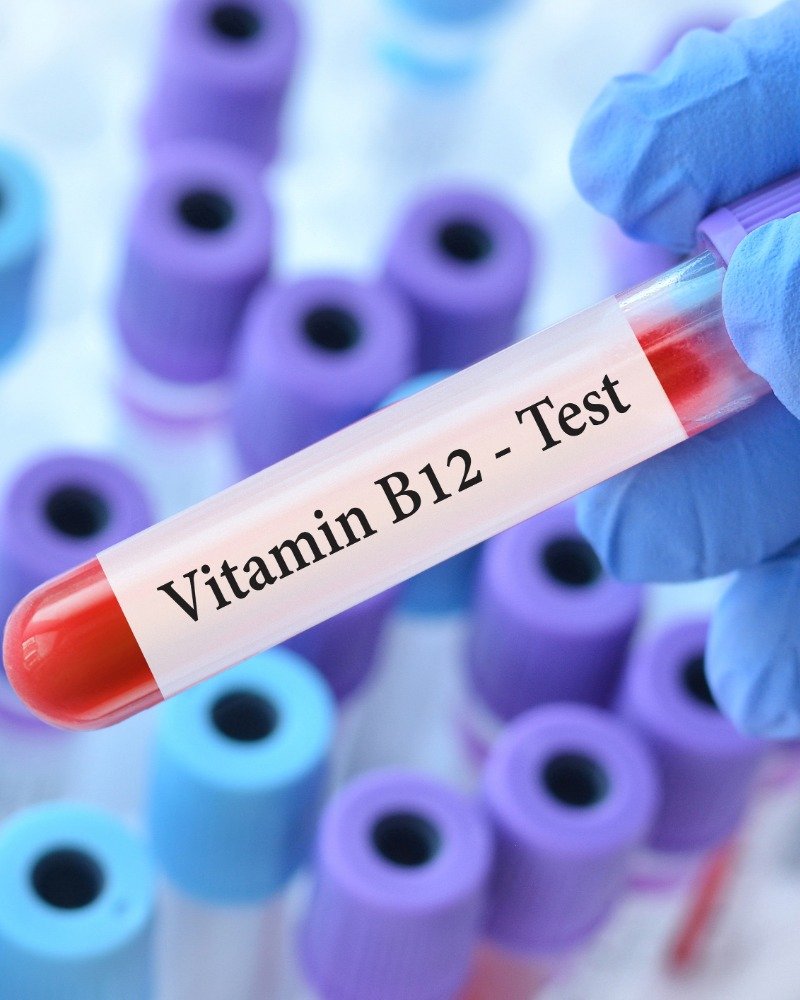 Serum Vitamin B12 रक्त जांच