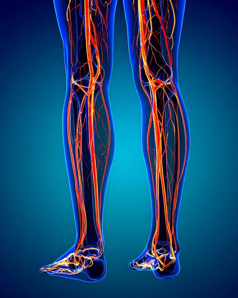 डायबिटिक न्यूरोपैथी में नसों को नुकसान का चित्र