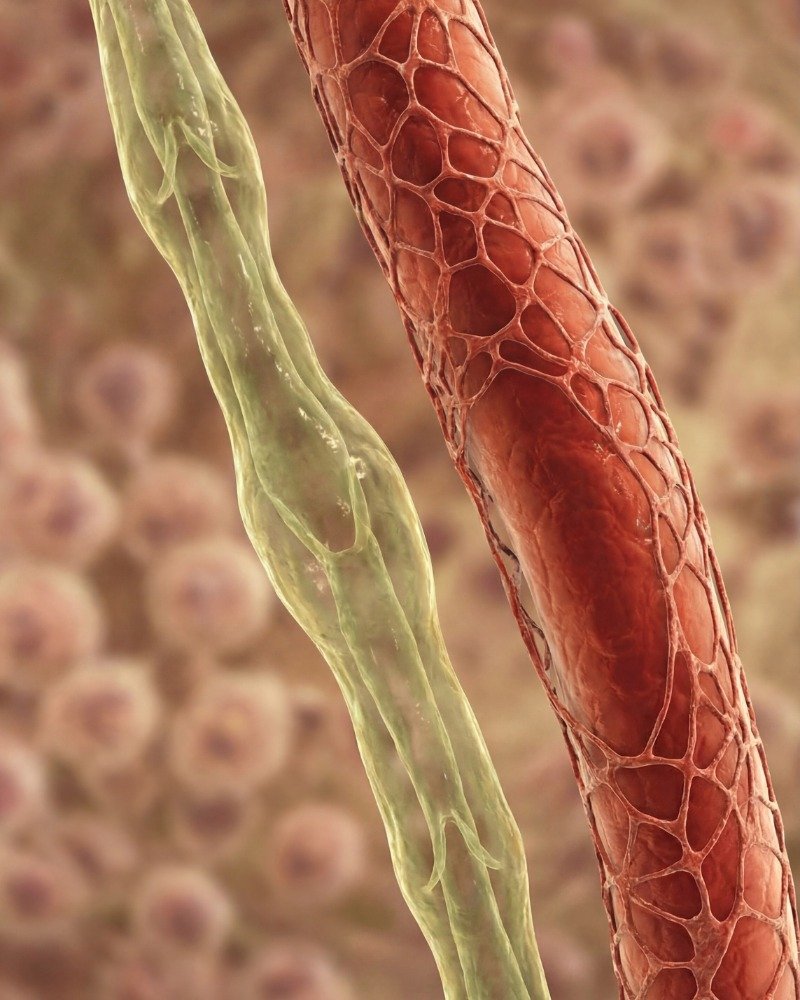 डायबिटीज में माइक्रोवेसल डैमेज और ब्लड सर्कुलेशन की कमी